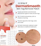 Skin Tag Remover Patch